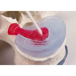 Juosmens slanksteliai su iškritusiais tarpslanksteliniais diskais su stovu - Erler Zimmer