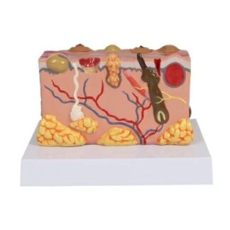 Patologinis odos modelis - Erler Zimmer