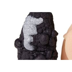 Plaučių vėžio palyginimo modelis - Erler Zimmer