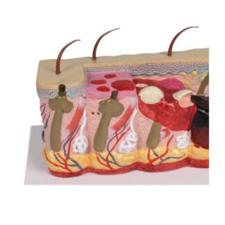 Patologinis odos modelis su nudegimais - Erler Zimmer